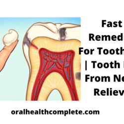 Tooth discoloration after trauma Reasons Treatments 10