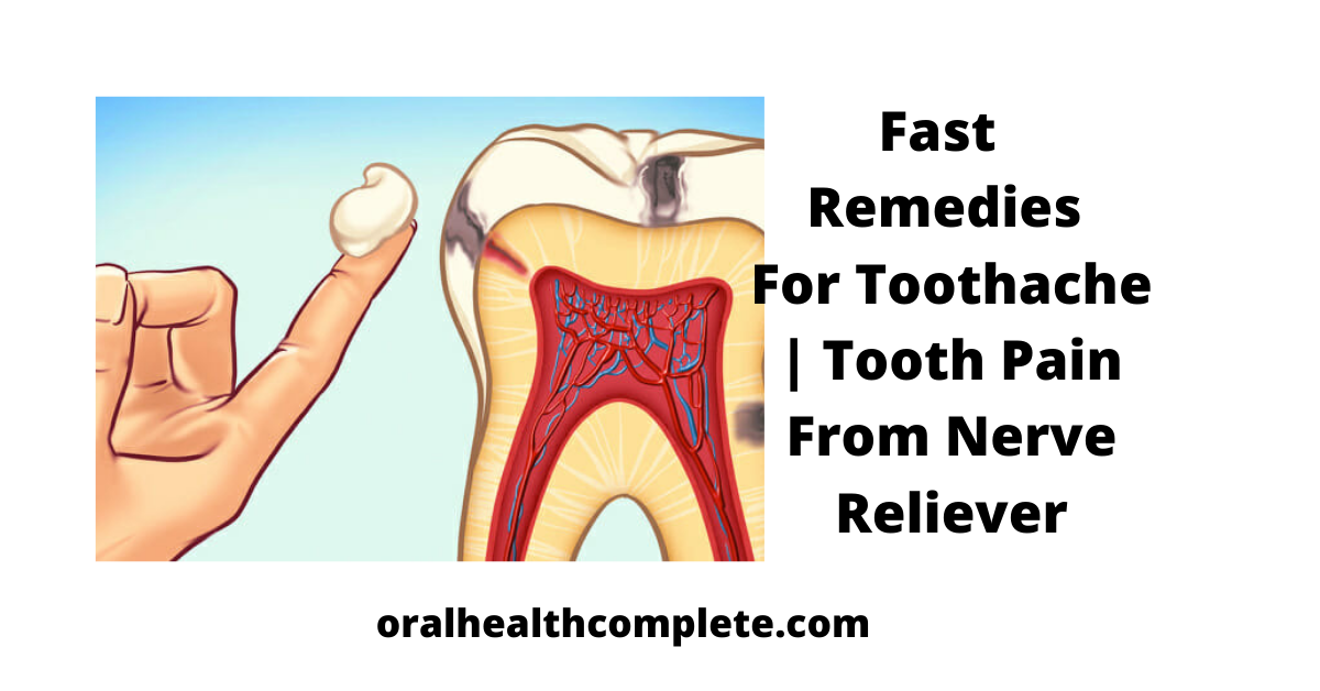 Tooth discoloration after trauma Reasons Treatments 10