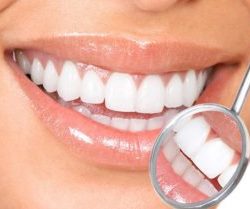 Healthy Teeth and Gums 300x209