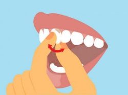 How to Pull Out Loose Tooth 300x187