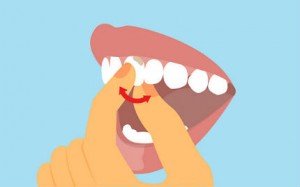 How to Pull Out Loose Tooth 300x187