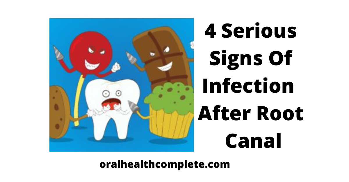 Tooth discoloration after trauma Reasons Treatments 7